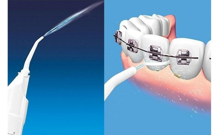 set 2 x Aparat de curatare interdentara - irigator bucal